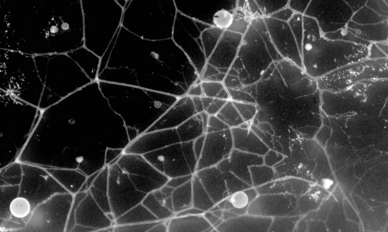 Микроскопическое изображение грибковых гиф AM